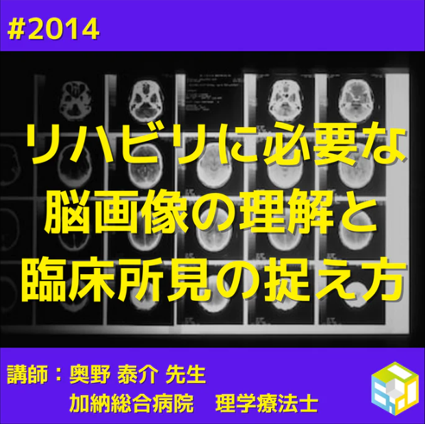 リハビリに必要な脳画像の理解と臨床所見の捉え方｜姿勢制御・歩行障害・Pusher症候群