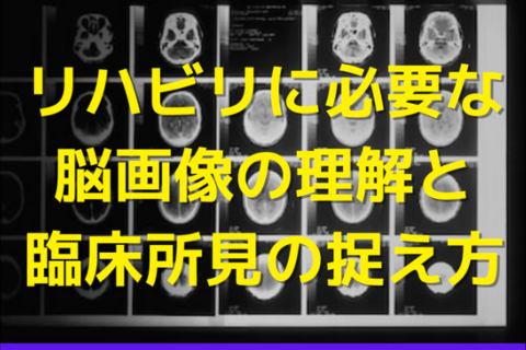リハビリに必要な脳画像の理解と臨床所見の捉え方｜姿勢制御・歩行障害・Pusher症候群
