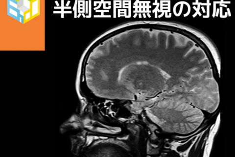基礎から学ぶ高次脳機能障害｜半側空間無視の理解とリハビリ