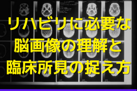 リハビリに必要な脳画像の理解と臨床所見の捉え方｜高次脳機能障害
