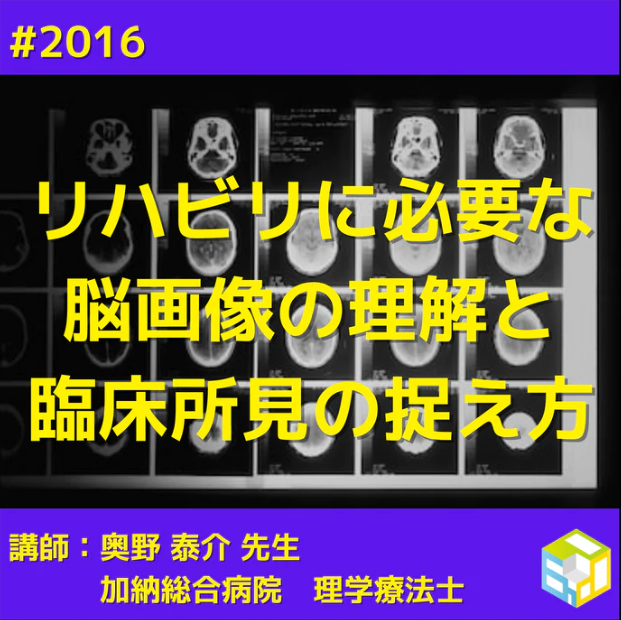 リハビリに必要な脳画像の理解と臨床所見の捉え方|応用編