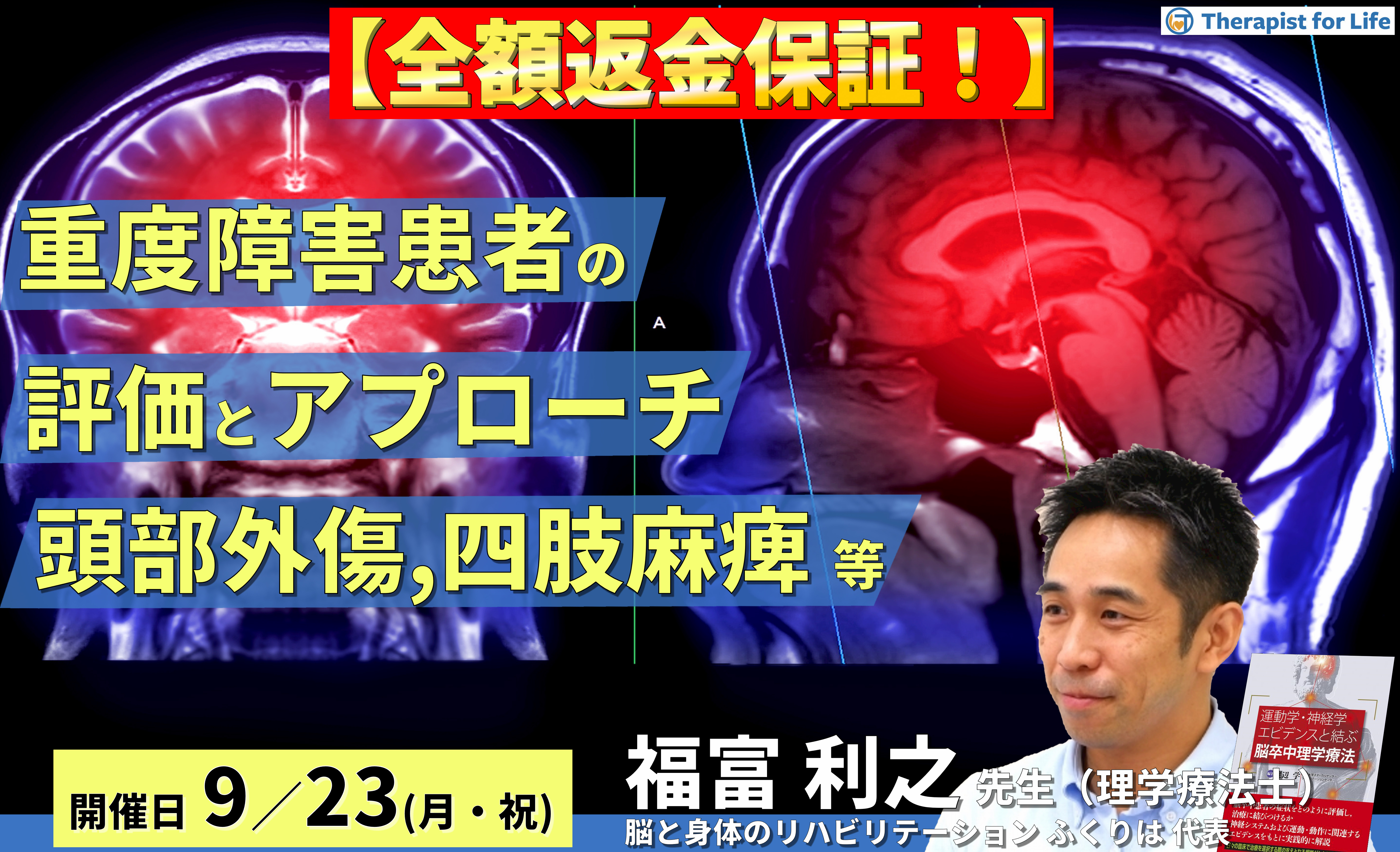 ※締切り間近【全額返金保証付き】重度障害患者の評価とアプローチ~頭部外傷、四肢麻痺、高次脳機能障害、全介助例などを中心に~ 講師:福富利之先生