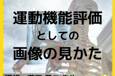 若手理学療法士・作業療法士向け運動機能評価としての整形外科疾患画像の読影方法｜上腕・上肢のレントゲン画像の診かた