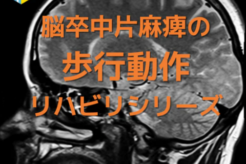 脳卒中片麻痺の姿勢制御に必要な基礎知識とリハビリの進め方