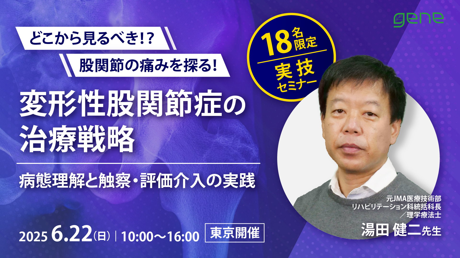 18名限定|変形性股関節症の治療戦略~病態理解と触察・評価介入の実践〜東京会場~