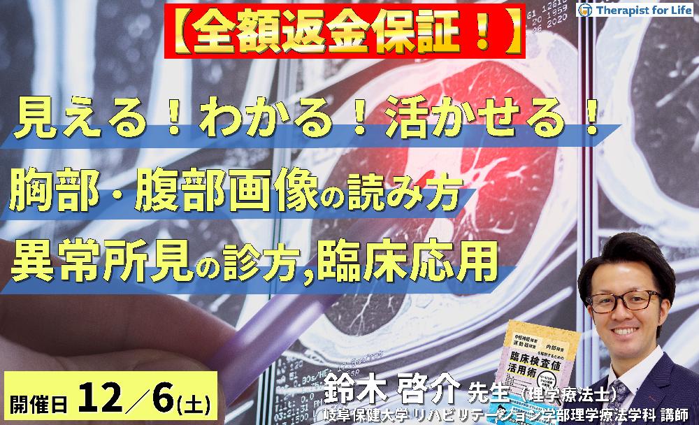 ※締切り間近【全額返金保証付き】PT・OT・STのための「見える!わかる!活かせる!胸部・腹部画像の読み方」 ~異常所見の診方とリハビリへの応用~ 講師:鈴木啓介先生