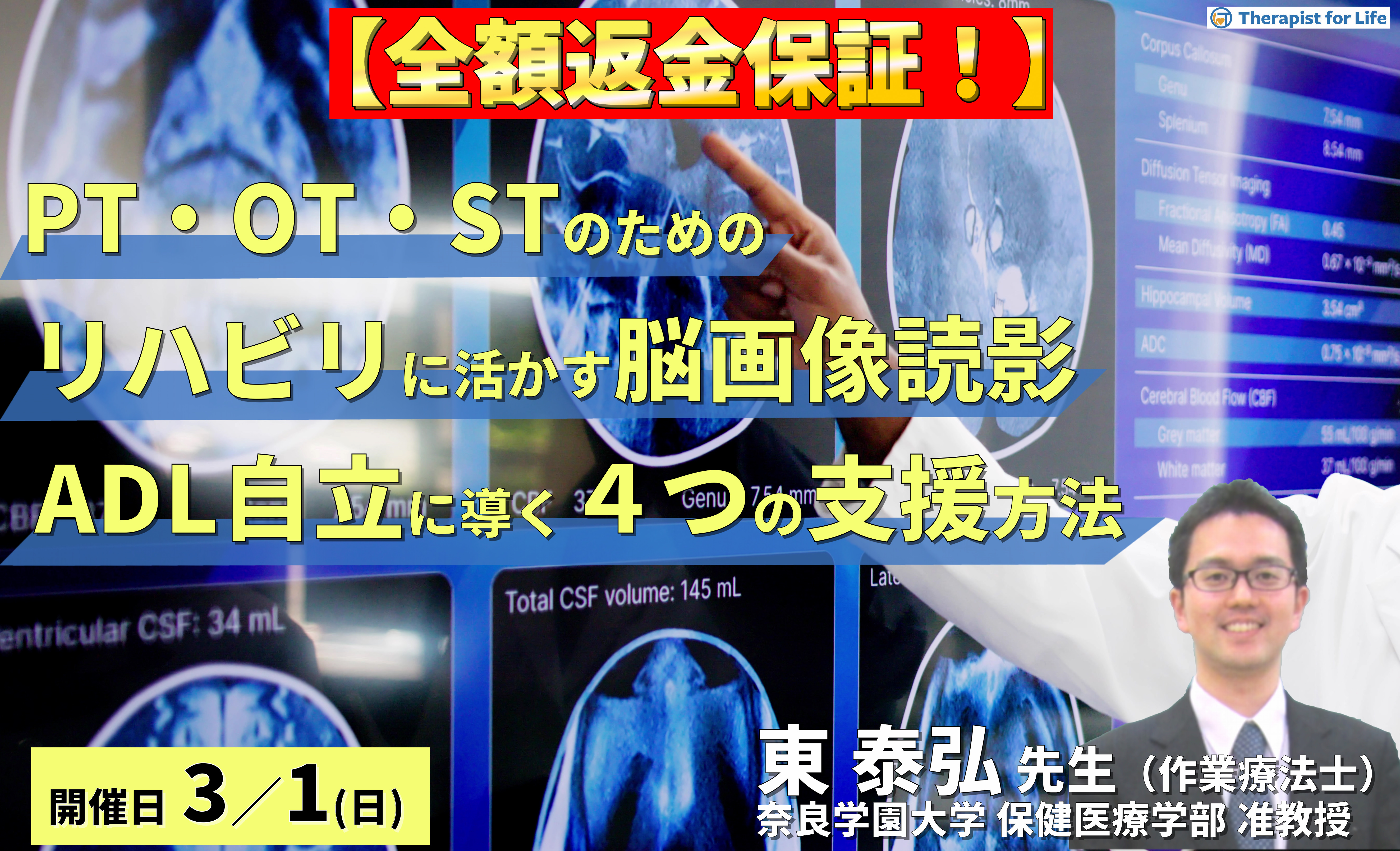 ※締切り間近【全額返金保証付き】(全2回)PT・OT・STのためのリハビリに活かす脳画像読影~「どこができなくて何が原因か」を読み解き、ADL自立へ導く4つの支援方法~ 講師:東泰弘先生