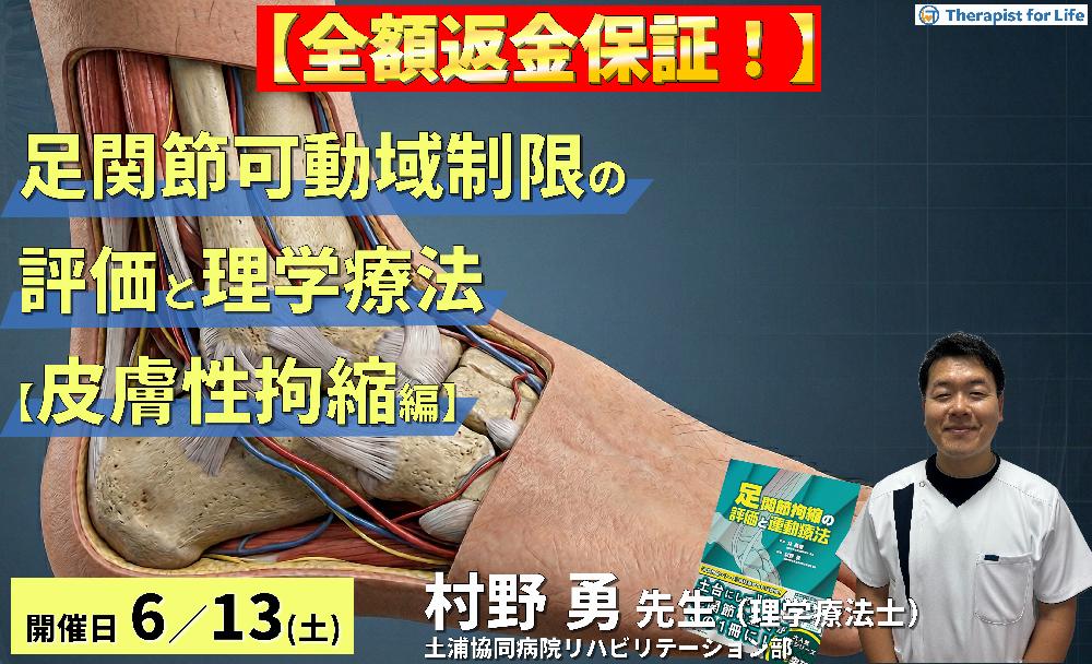 ※締切り間近【皮膚性拘縮編】足関節可動域制限の評価と運動療法~皮膚性・筋性拘縮の鑑別とエコー・触診による臨床介入~ 講師:村野勇先生