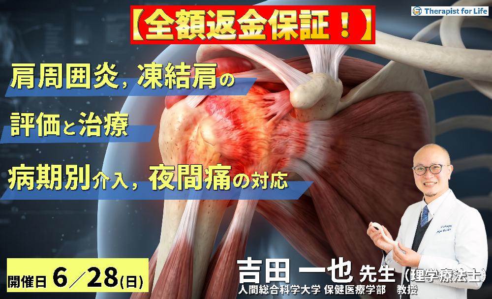 【早割中!】肩関節周囲炎・凍結肩の評価と治療〜病期で変わるアプローチと夜間痛への対応〜 講師:吉田一也先生