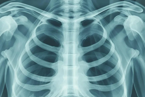 呼吸リハに必要なCOPD・間質性肺炎の理解｜医療・リハビリ職のための呼吸リハスクール基礎編